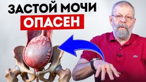 Интимная проблема после праздников