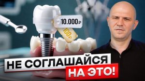 Как Стоматологи Разводят Клиентов? Как Обманывают на Имплантах