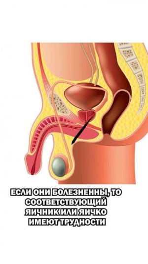 Проверь интимное здоровье за 1 минуту