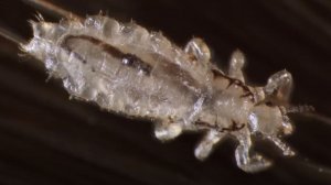 От чего появляются вши на голове у человека: одна-единственная причина