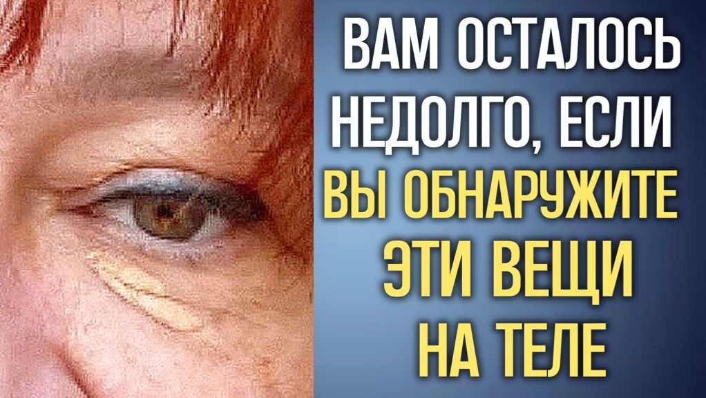 Если вы обнаружите эти вещи на теле, СРОЧНО звоните ВРАЧУ пока не поздно смотреть онлайн