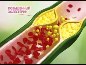 Реклама Атероклефит Эвалар (2014)
