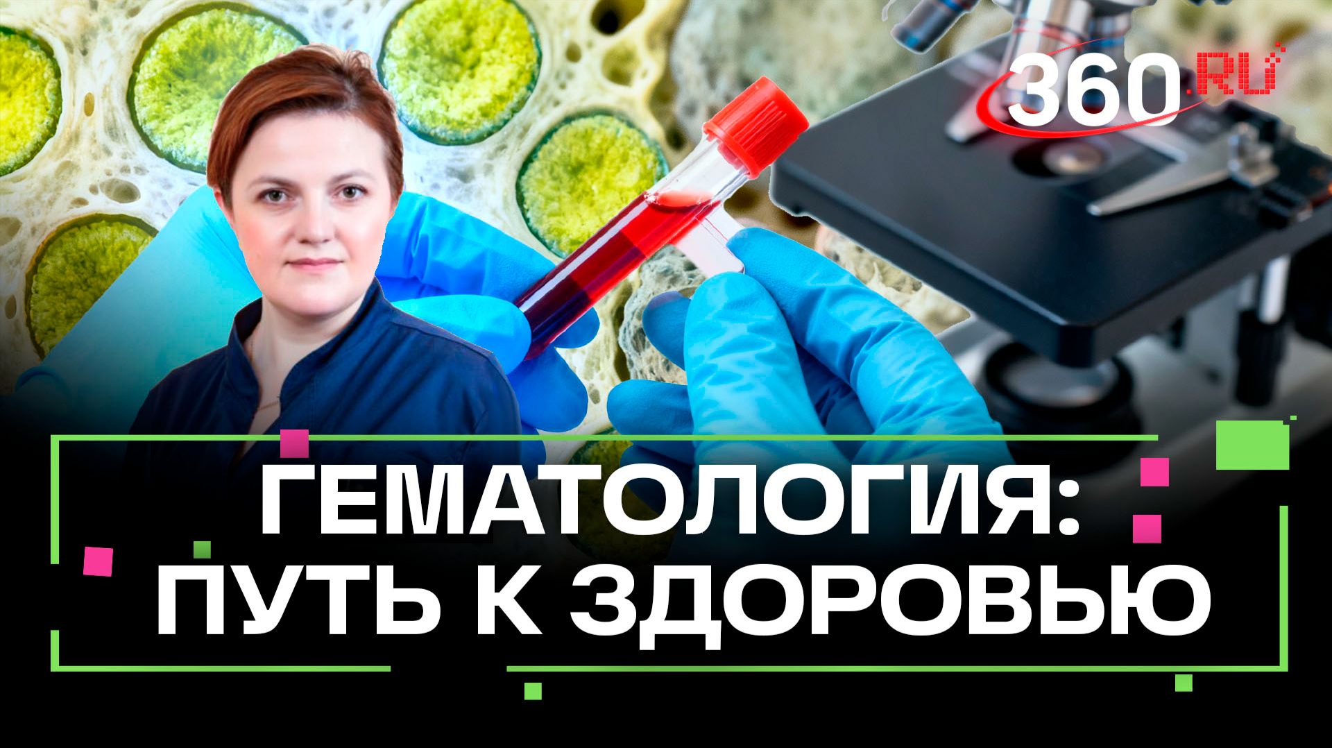 Миелодиспластический синдром: как снизить риски? смотреть онлайн