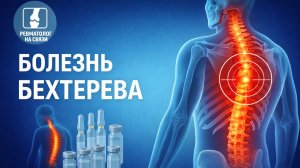 Болезнь Бехтерева