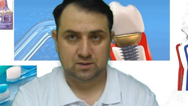 Часто задаваемые вопросы по зубной имплантации. Как пользоваться протезами на имплантах?.