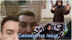 САМВЕЛ АДАМЯН ОБЗОР , ГАРИК И КЕРРИ, НОВЫЙ ГОД С СИНЯКАМИ НА ЛИЦЕ, НОВЫЙ ЦВЕТ ВОЛОС У КЕРРИ..