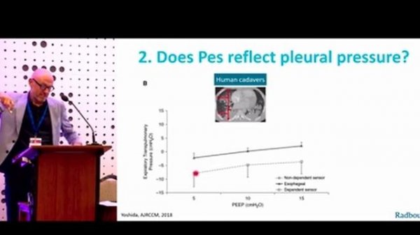 LIVES PHYSIOLOGY Legacy of Luciano Gattinoni in respiratory physiology - Heunks l.