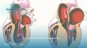 ЭКГ и ЭхоКГ детям