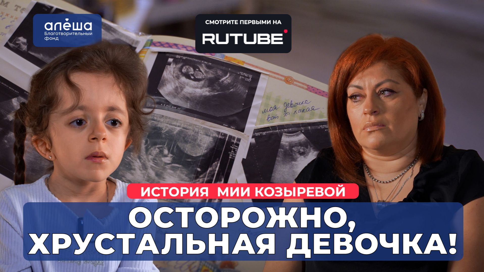 НЕЗАВЕРШЁННЫЙ ОСТЕОГЕНЕЗ | История Мии Козыревой смотреть онлайн