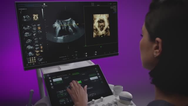 GE Voluson Signature 18 смотреть онлайн
