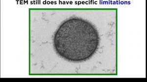 электронная микроскопия обьяснение