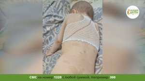 Двухлетка Лиза гибнет от рака! Помогите!