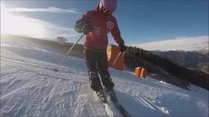 Ангуляция коленей вариант № 1