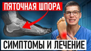 ГЛАВНАЯ причина, почему у ВАС БОЛЯТ ПЯТКИ! Как вылечить БОЛЬ В ПЯТКЕ без врача?