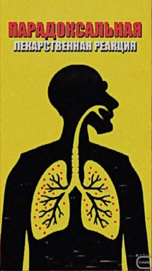 📚 Эта бездомная женщина принимала таблетки повлёкшие тяжёлые мутации.📚