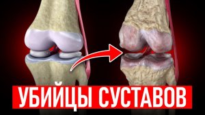 ЭТИ продукты НЕЗАМЕТНО РАЗРУШАЮТ ваши СУСТАВЫ! Как питаться, чтобы поддержать здоровье костей?