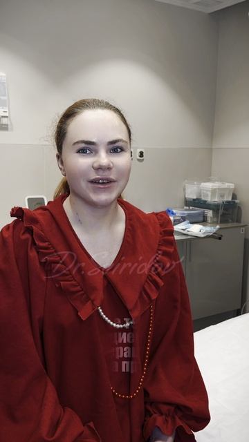 Отзыв моей прекрасной пациентки спустя 5 дней после липосакции подбородка! смотреть онлайн