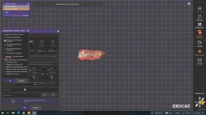 ExoCad гипсовка в виртуальный артикулятор