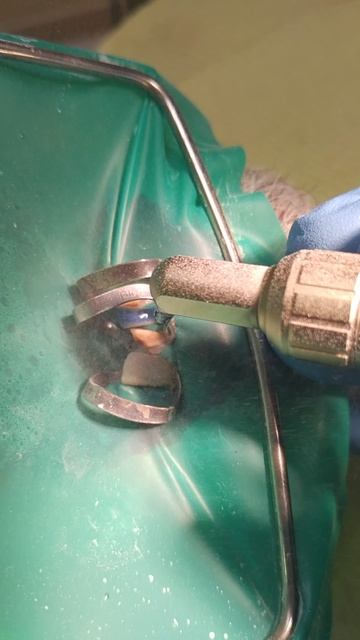 Абразивная отработка поверхности 31 зуба.#abrasiveblasting