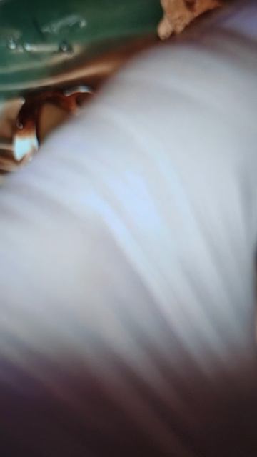 Абразивная обработка поверхности зуба 21.