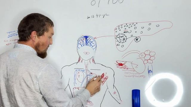 ХИДЖАМА ПОМОГАЕТ В ЛЕЧЕНИИ АТЕРОСКЛЕРОЗА?КАК ЛИШНЯЯ Г смотреть онлайн