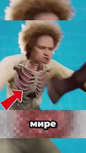 Что будет, если лошадь ударит копытом_