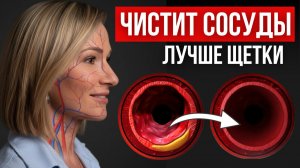 Как очистить сосуды от бляшек и тромбов за 5 простых шагов дома? Как лечить атеросклероз?
