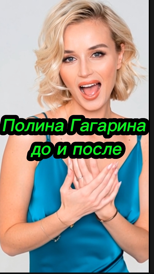 AI. Полина Гагарина до и после