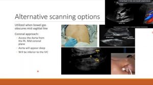 УЗИ аорты (рама) лекция для врачей