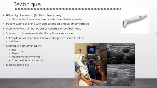 Периферический венозный доступ под контролем УЗИ лекция для врачей