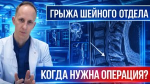 Грыжа и стеноз шейного отдела позвоночника. Сдавление спинного мозга и шейная миелопатия