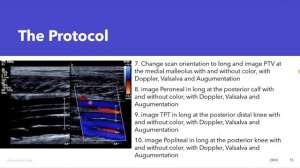 УЗИ вен  нижних конечностей (рама) лекция для врачей