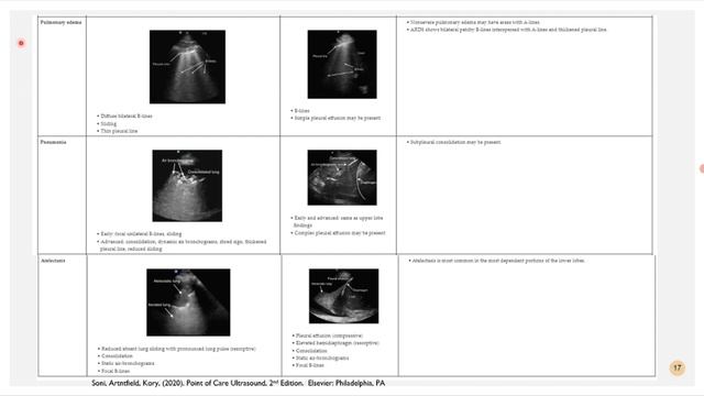 УЗИ легких и плевры лекция 2. (рама) для врачей УЗИ