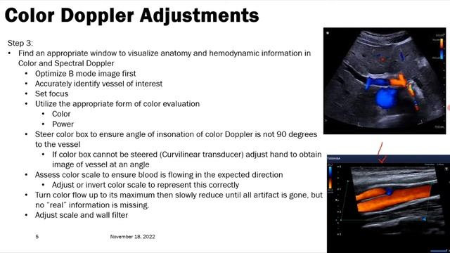 Улучшение сканирования на УЗИ (рама) лекция для врачей