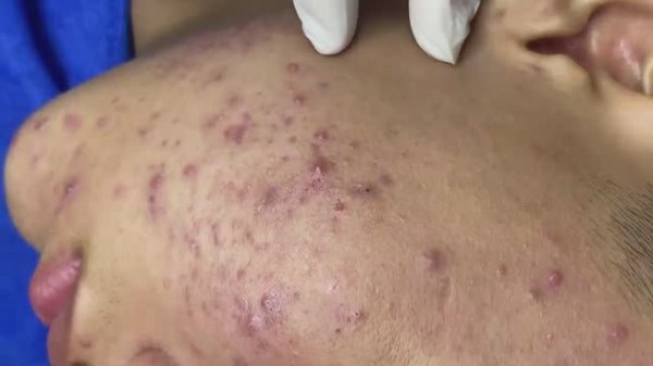 Relax Spa 045 • АСМР • SacDepSpa collection