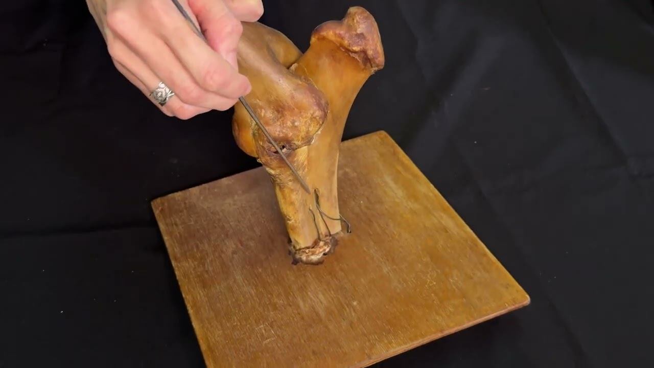 Локтевой сустав