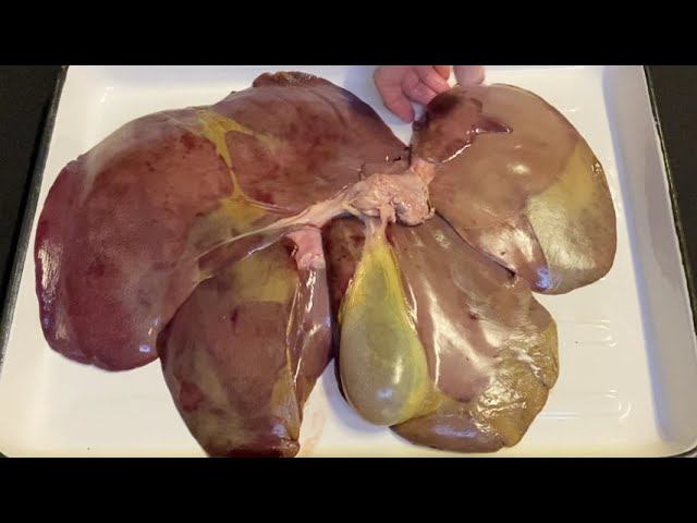 Строение печени