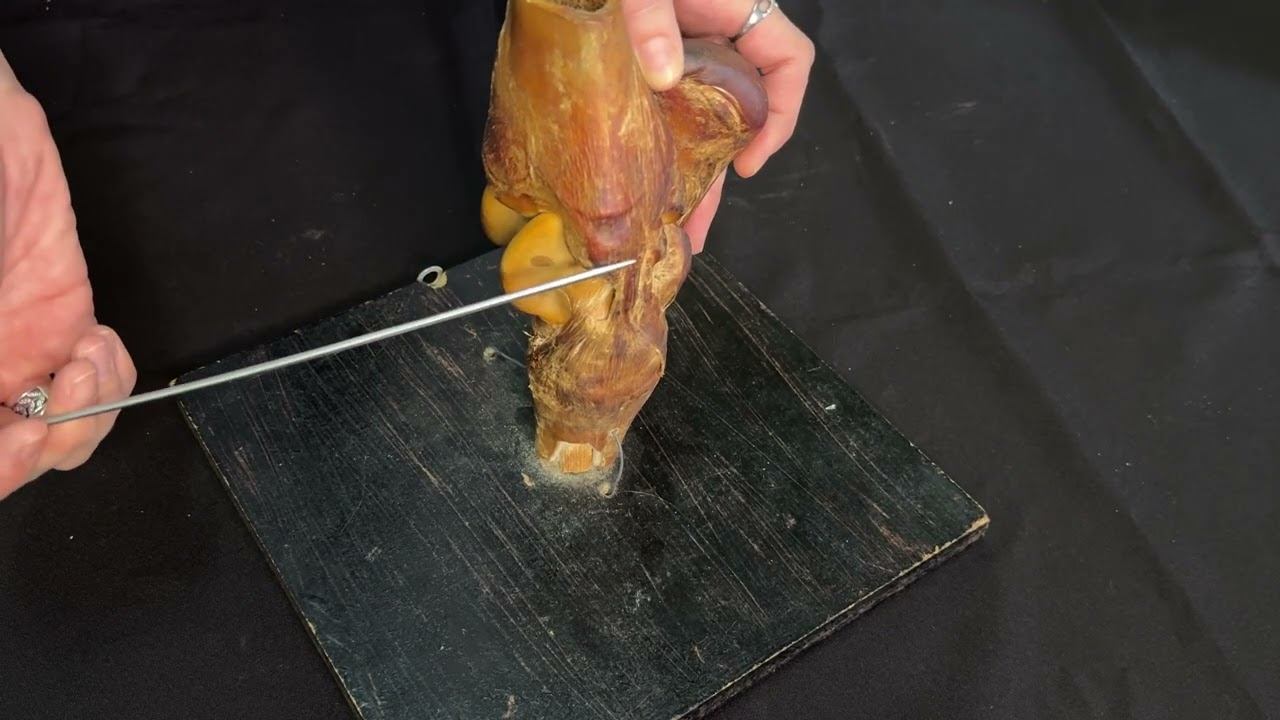 Заплюсневый сустав