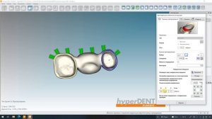 Алгоритм работы с HyperDent