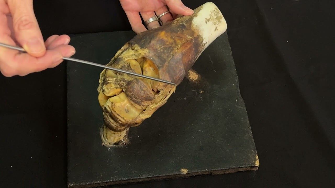 Запястный сустав