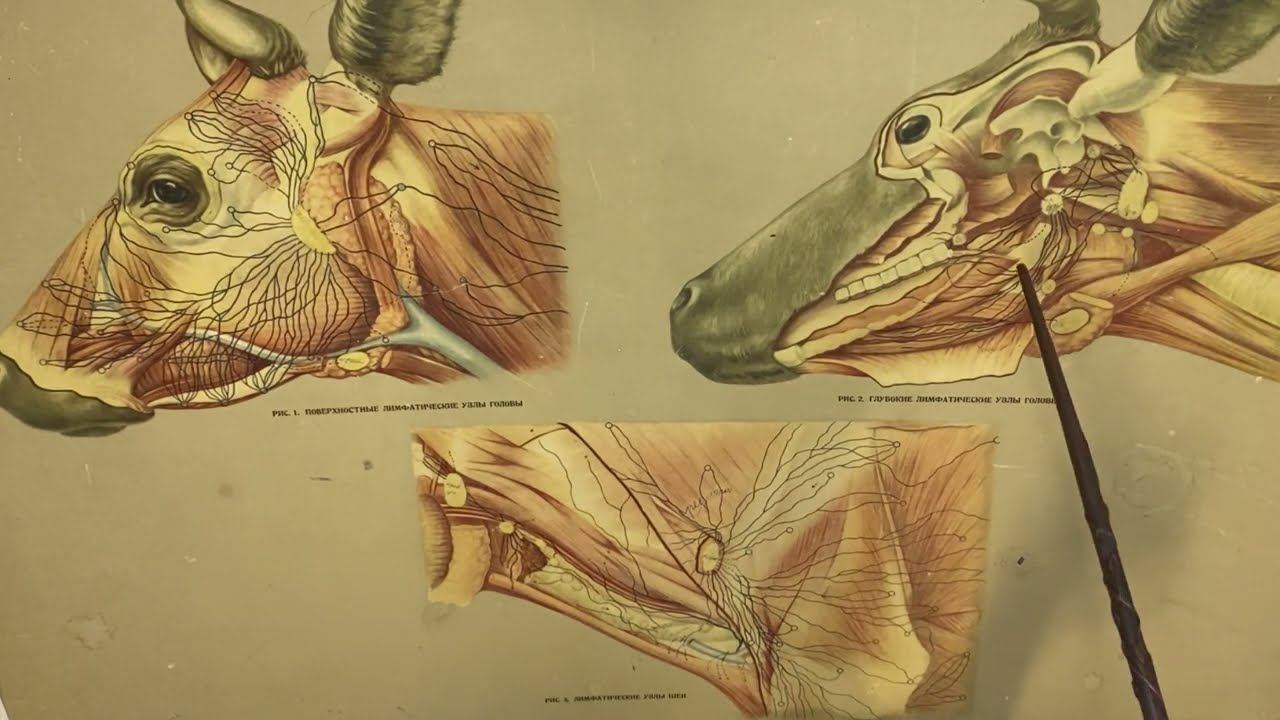 Лимфатические узлы головы и шеи