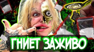 ГНИЕТ ЗАЖИВО | ЛАПА ХАПА ТРЕШ БЛОГЕР | ТРЕШ ОБЗОР