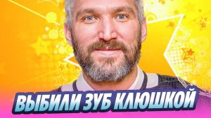 Овечкину выбили зуб и разбили лицо клюшкой 🔥 Новости Шоу-Бизнеса