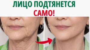 СКРЫТЫЕ ПРИЧИНЫ ПТОЗА. Лицо подтягивается на глазах