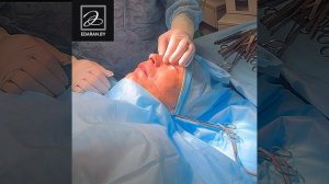 Ринопластика с помощью Пьезо