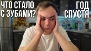 Что стало с моими турецкими зубами через год? Что сказал врач на приеме?