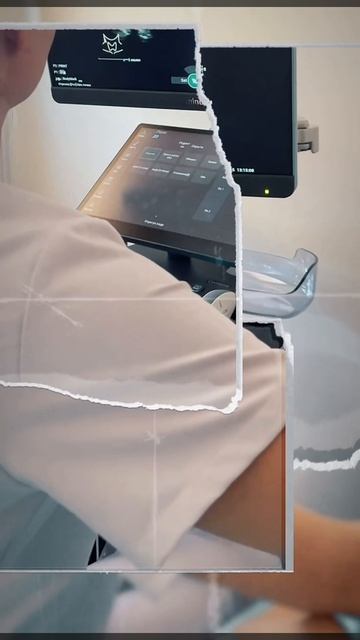 УЗИ диагностика щитовидной железы