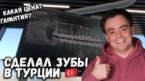 СДЕЛАЛ ЗУБЫ В ТУРЦИИ. СКОЛЬКО СТОИТ ГОЛЛИВУДСКАЯ УЛЫБКА?