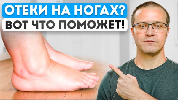 Убери ОТЁКИ НА НОГАХ за 5 минут в день - Упражнения в домашних условиях!