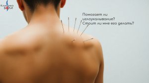 Помогает ли иглоукалывание? Стоит ли мне его делать?